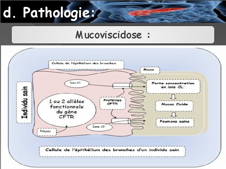 d. Pathologie: Mucoviscidose : 
