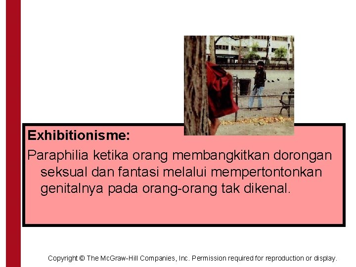 Exhibitionisme: Paraphilia ketika orang membangkitkan dorongan seksual dan fantasi melalui mempertontonkan genitalnya pada orang-orang