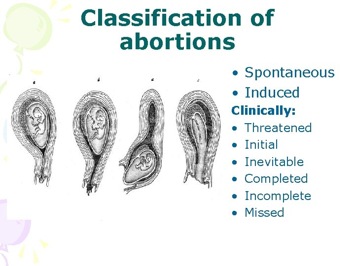 Classification of abortions • Spontaneous • Induced Clinically: • Threatened • Initial • Inevitable