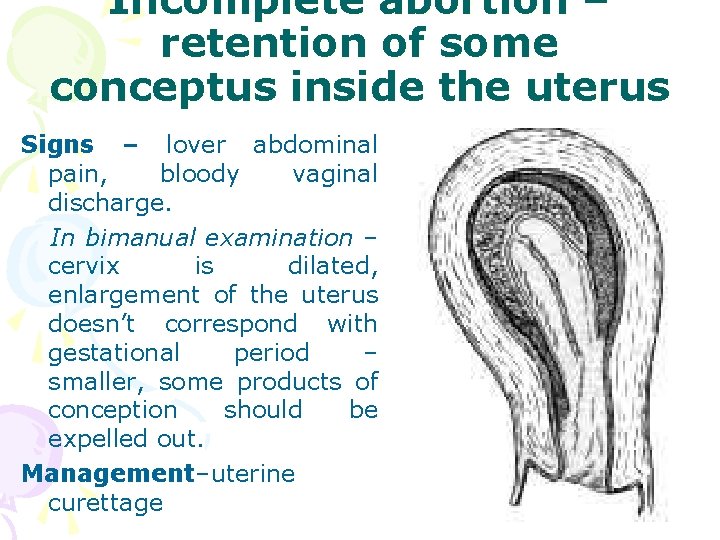 Incomplete abortion – retention of some conceptus inside the uterus Signs – lover abdominal