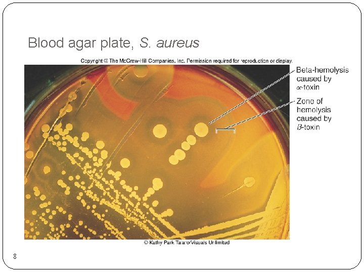Blood agar plate, S. aureus 8 