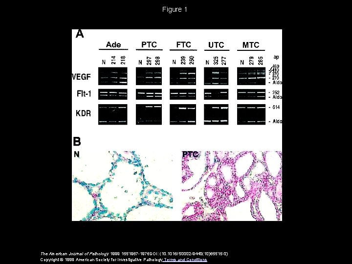 Figure 1 The American Journal of Pathology 1999 1551967 -1976 DOI: (10. 1016/S 0002