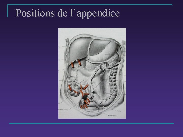 Positions de l’appendice 