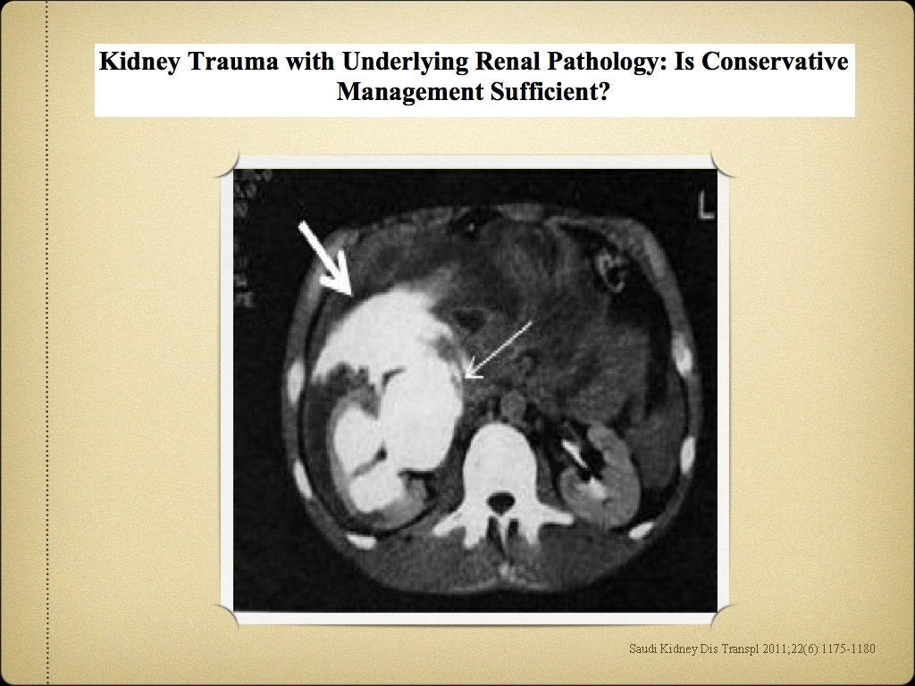 Saudi Kidney Dis Transpl 2011; 22(6): 1175 -1180 