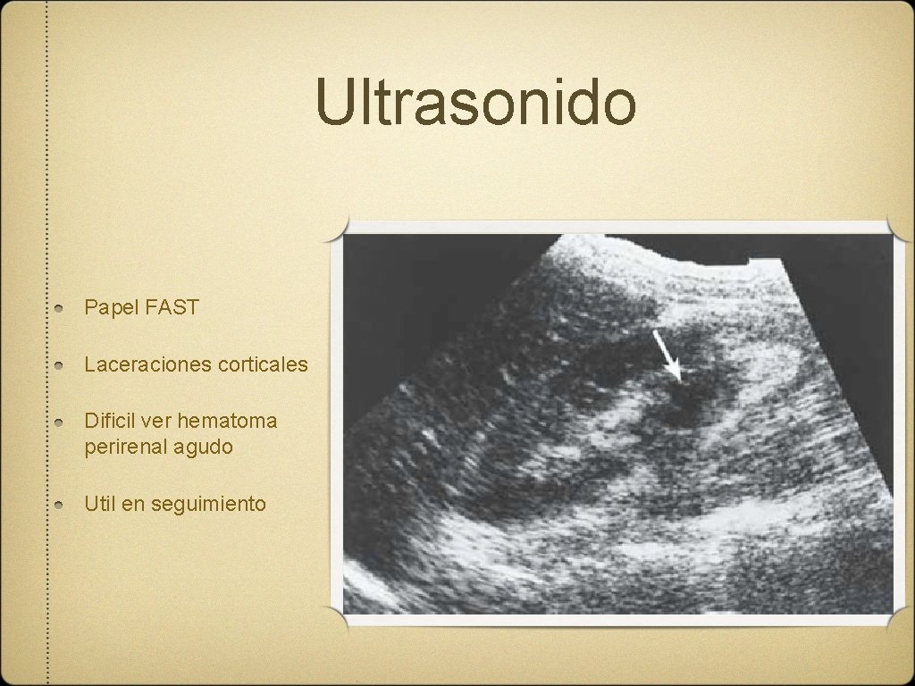 Ultrasonido Papel FAST Laceraciones corticales Dificil ver hematoma perirenal agudo Util en seguimiento 