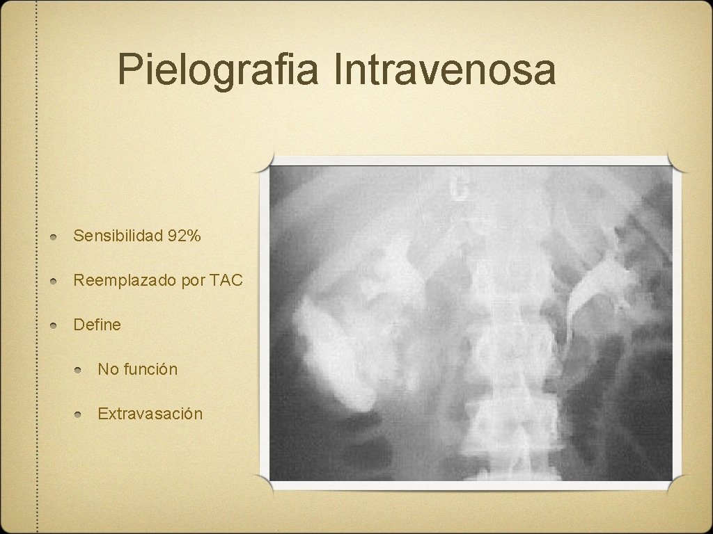 Pielografia Intravenosa Sensibilidad 92% Reemplazado por TAC Define No función Extravasación 