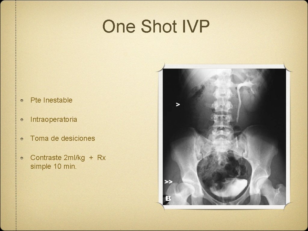 One Shot IVP Pte Inestable Intraoperatoria Toma de desiciones Contraste 2 ml/kg + Rx