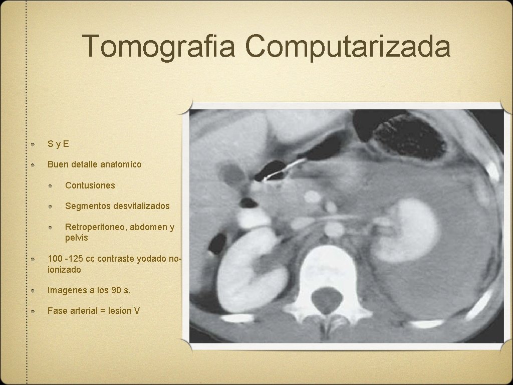 Tomografia Computarizada Sy. E Buen detalle anatomico Contusiones Segmentos desvitalizados Retroperitoneo, abdomen y pelvis