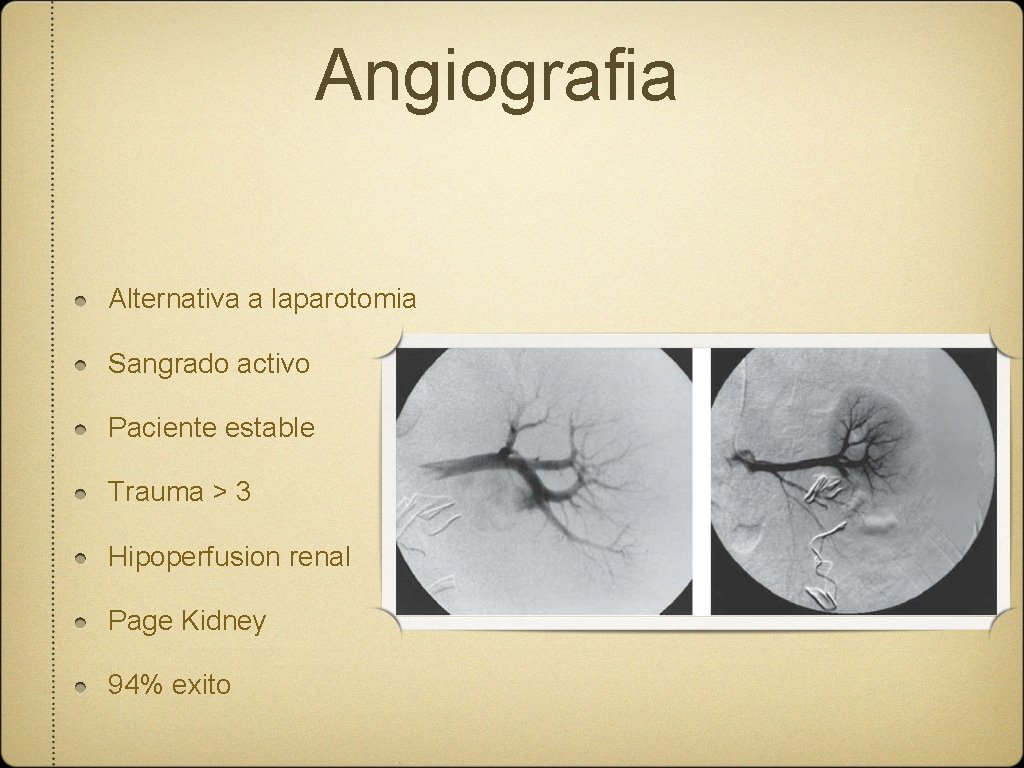 Angiografia Alternativa a laparotomia Sangrado activo Paciente estable Trauma > 3 Hipoperfusion renal Page