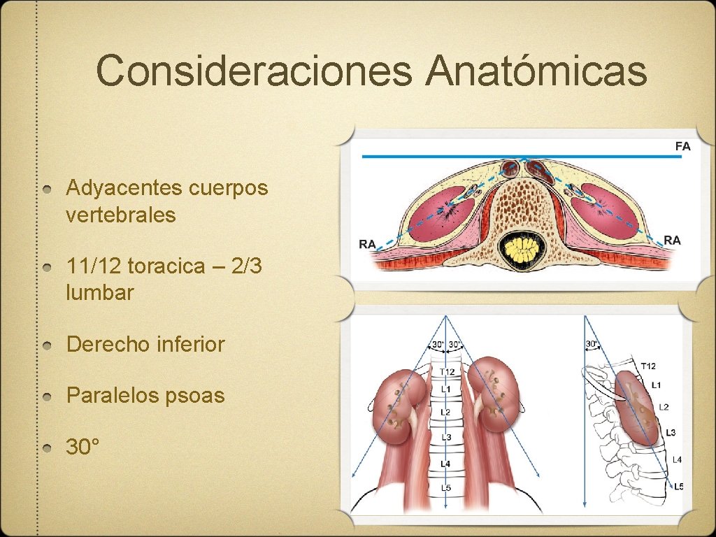 Consideraciones Anatómicas Adyacentes cuerpos vertebrales 11/12 toracica – 2/3 lumbar Derecho inferior Paralelos psoas
