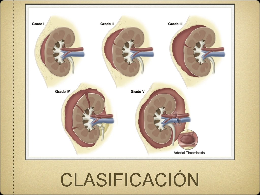 CLASIFICACIÓN 
