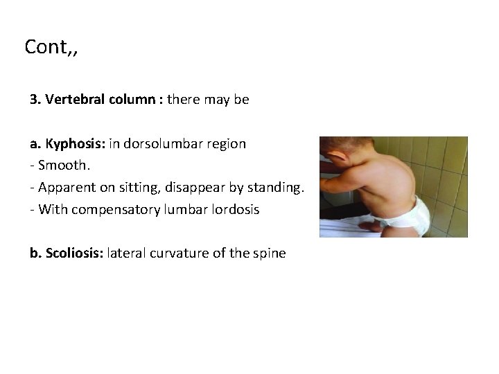 Cont, , 3. Vertebral column : there may be a. Kyphosis: in dorsolumbar region