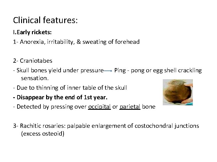 Clinical features: I. Early rickets: 1 - Anorexia, irritability, & sweating of forehead 2