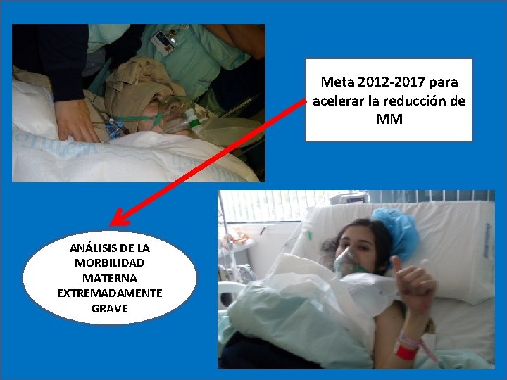 Meta 2012 -2017 para acelerar la reducción de MM ANÁLISIS DE LA MORBILIDAD MATERNA