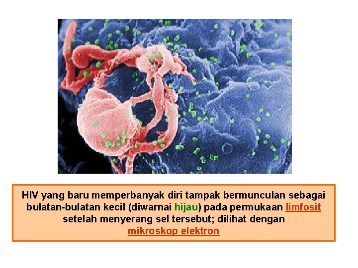 HIV yang baru memperbanyak diri tampak bermunculan sebagai bulatan-bulatan kecil (diwarnai hijau) pada permukaan