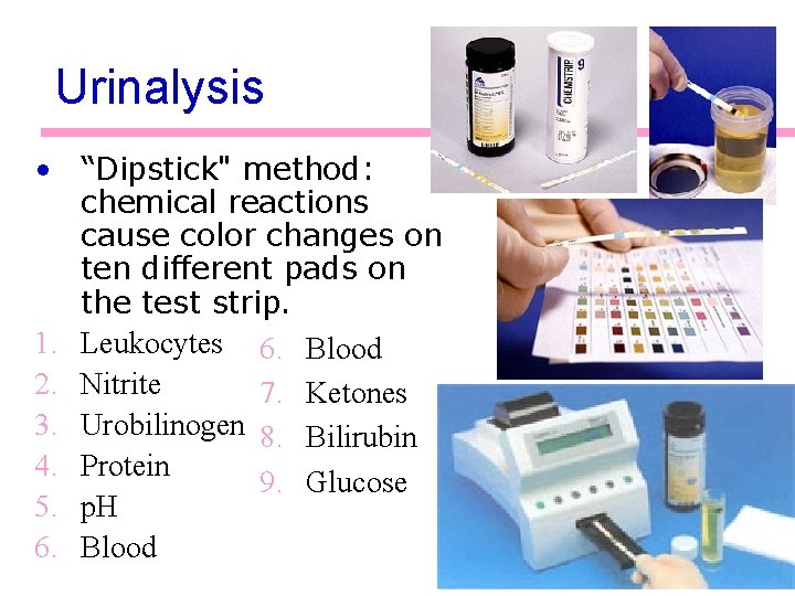 Urinalysis • “Dipstick" method: chemical reactions cause color changes on ten different pads on