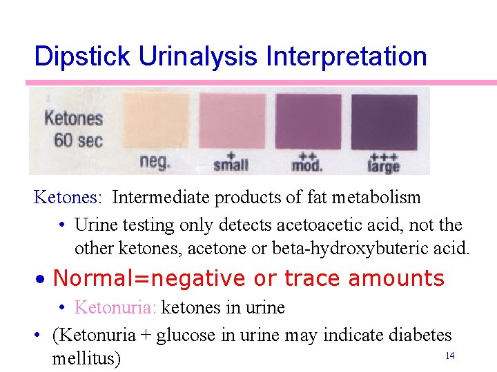 Dipstick Urinalysis Interpretation Ketones: Intermediate products of fat metabolism • Urine testing only detects