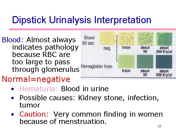 Dipstick Urinalysis Interpretation Blood: Almost always indicates pathology because RBC are too large to