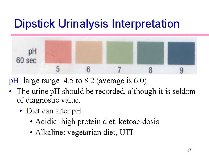 Dipstick Urinalysis Interpretation p. H: large range 4. 5 to 8. 2 (average is