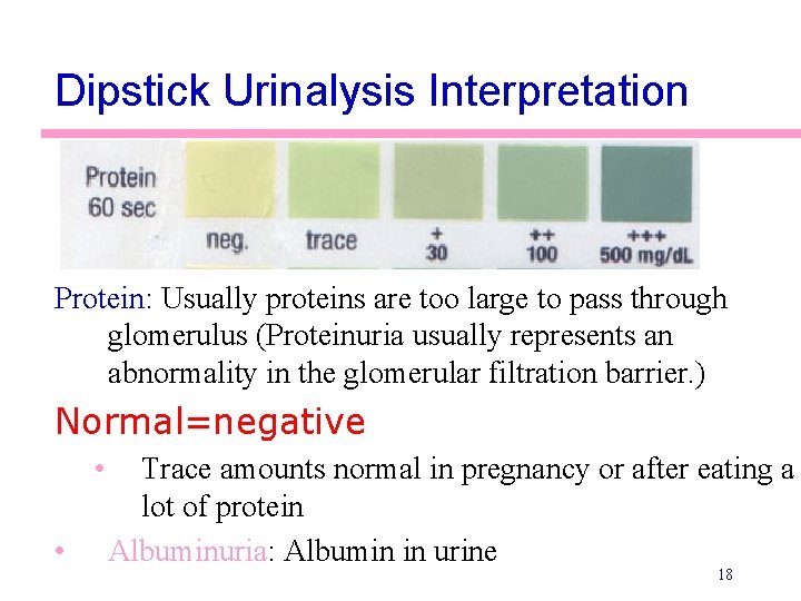 Dipstick Urinalysis Interpretation Protein: Usually proteins are too large to pass through glomerulus (Proteinuria