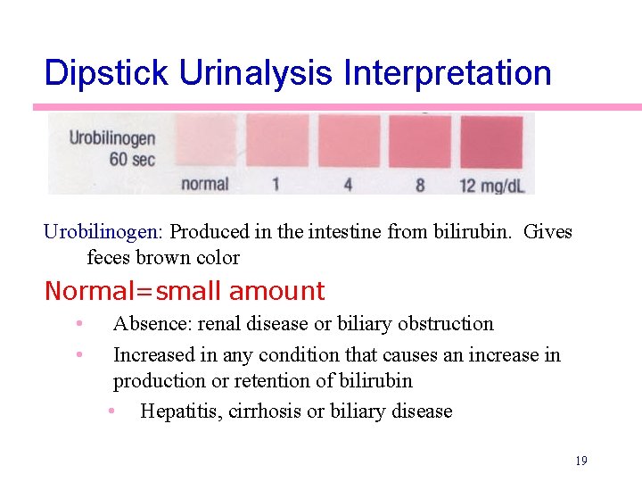 Dipstick Urinalysis Interpretation Urobilinogen: Produced in the intestine from bilirubin. Gives feces brown color