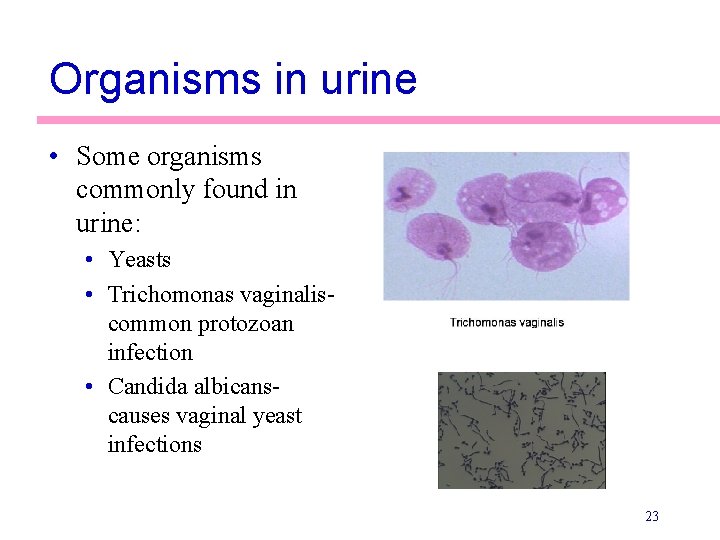 Organisms in urine • Some organisms commonly found in urine: • Yeasts • Trichomonas