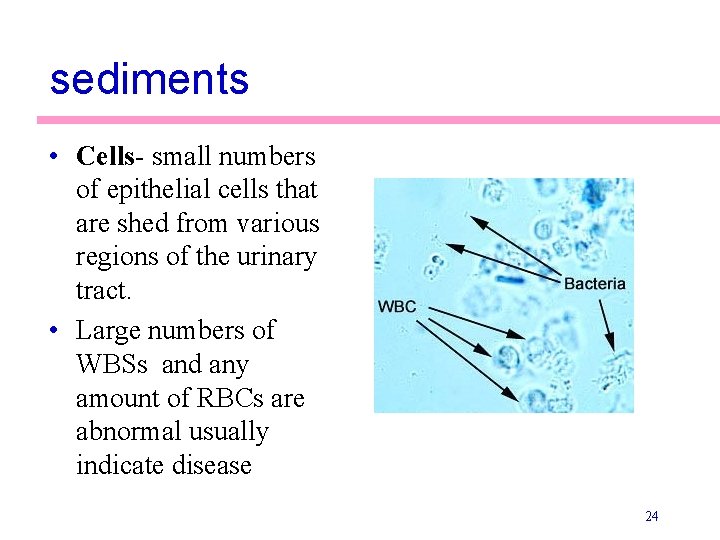 sediments • Cells- small numbers of epithelial cells that are shed from various regions