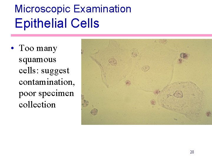 Microscopic Examination Epithelial Cells • Too many squamous cells: suggest contamination, poor specimen collection