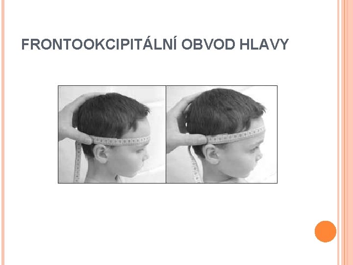 FRONTOOKCIPITÁLNÍ OBVOD HLAVY 