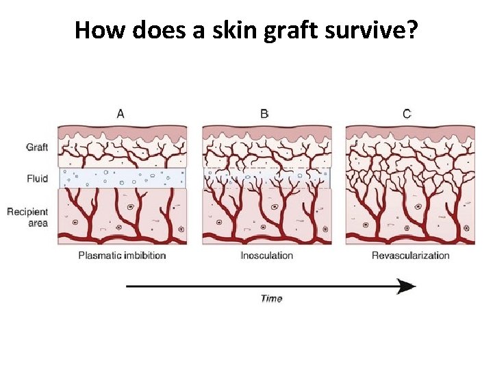 How does a skin graft survive? 