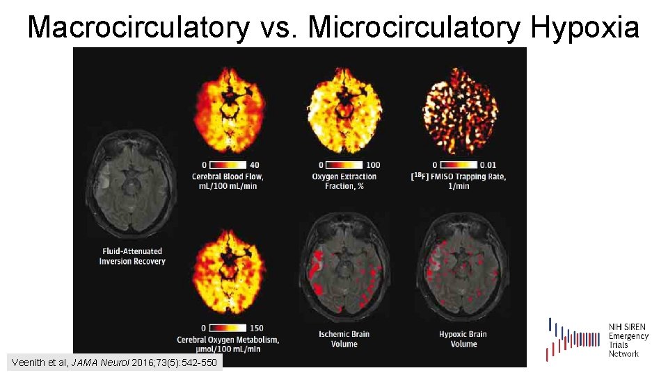 Macrocirculatory vs. Microcirculatory Hypoxia Veenith et al, JAMA Neurol 2016; 73(5): 542 -550 