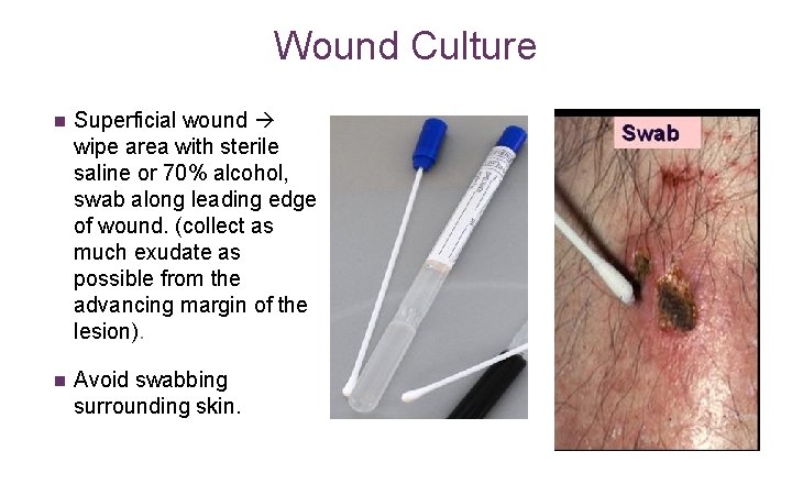 Wound Culture n Superficial wound wipe area with sterile saline or 70% alcohol, swab