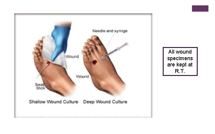 All wound specimens are kept at R. T. 