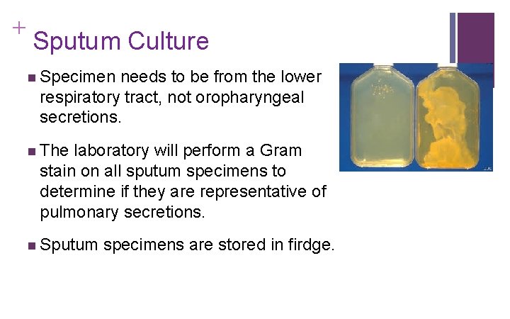 + Sputum Culture n Specimen needs to be from the lower respiratory tract, not