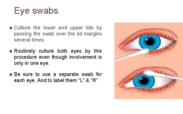 Eye swabs n Culture the lower and upper lids by passing the swab over
