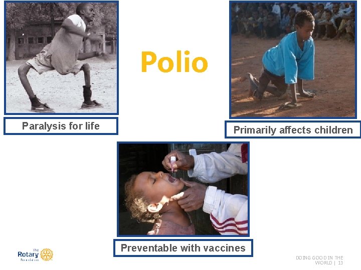 Polio Paralysis for life Primarily affects children Preventable with vaccines DOING GOOD IN THE