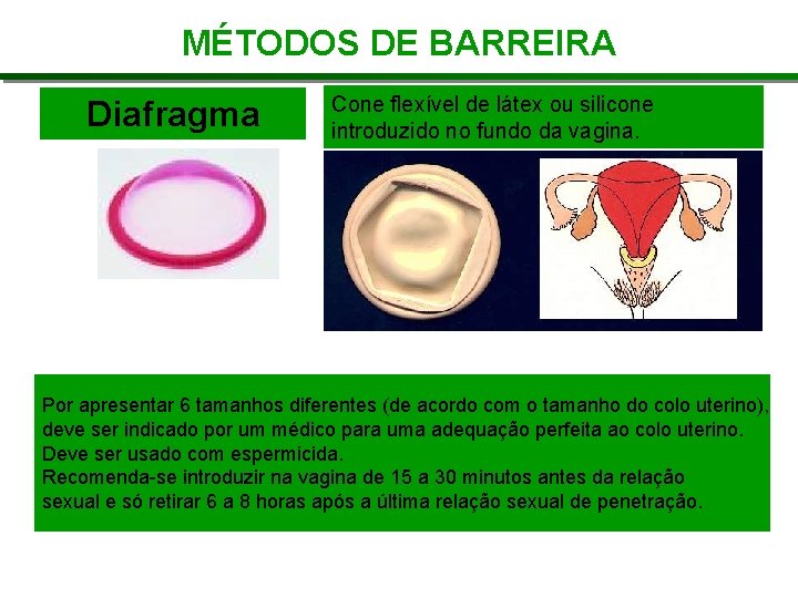 MÉTODOS DE BARREIRA Diafragma Cone flexível de látex ou silicone introduzido no fundo da