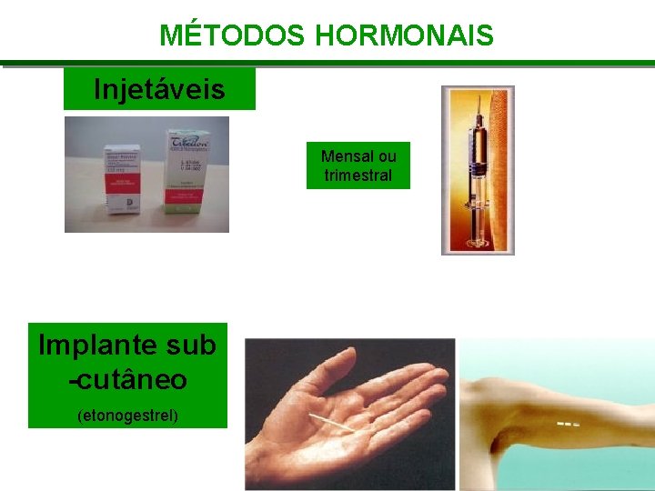 MÉTODOS HORMONAIS Injetáveis Mensal ou trimestral Implante sub -cutâneo (etonogestrel) 