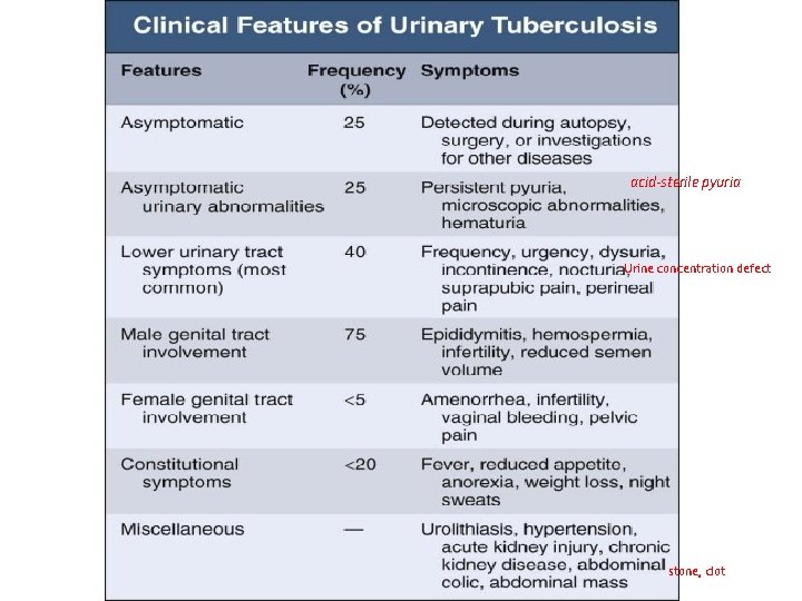 acid-sterile pyuria Urine concentration defect stone, clot 