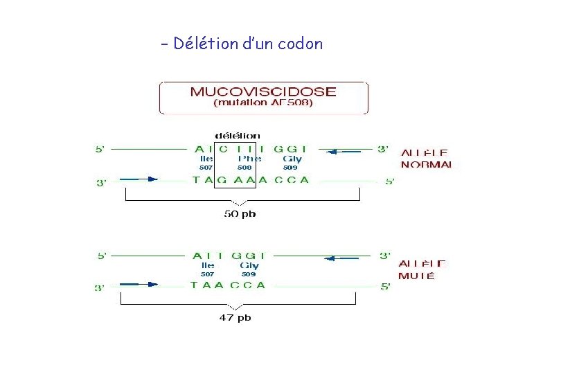 – Délétion d’un codon 