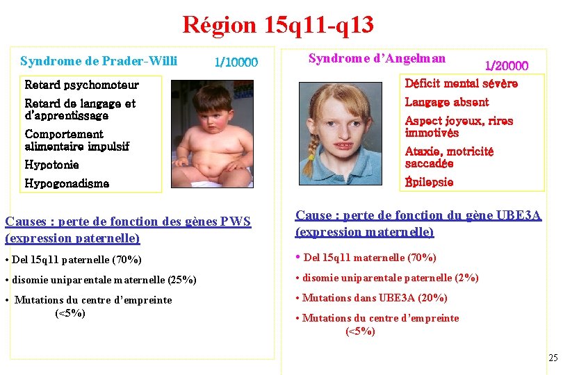 Région 15 q 11 -q 13 Syndrome de Prader-Willi 1/10000 Syndrome d’Angelman 1/20000 Retard