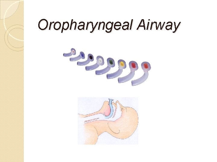 Oropharyngeal Airway 