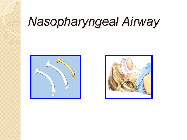 Nasopharyngeal Airway 