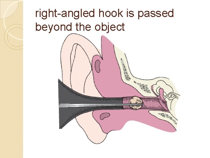 right-angled hook is passed beyond the object 