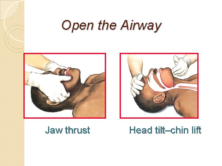 Open the Airway Jaw thrust Head tilt–chin lift 