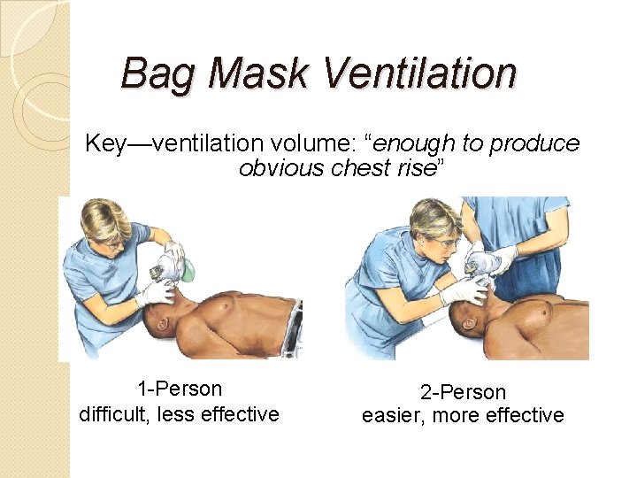 Bag Mask Ventilation Key—ventilation volume: “enough to produce obvious chest rise” 1 -Person difficult,