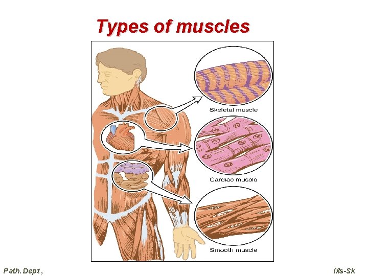 Types of muscles Path. Dept , Ms-Sk  Types of muscles Path. Dept , Ms-Sk