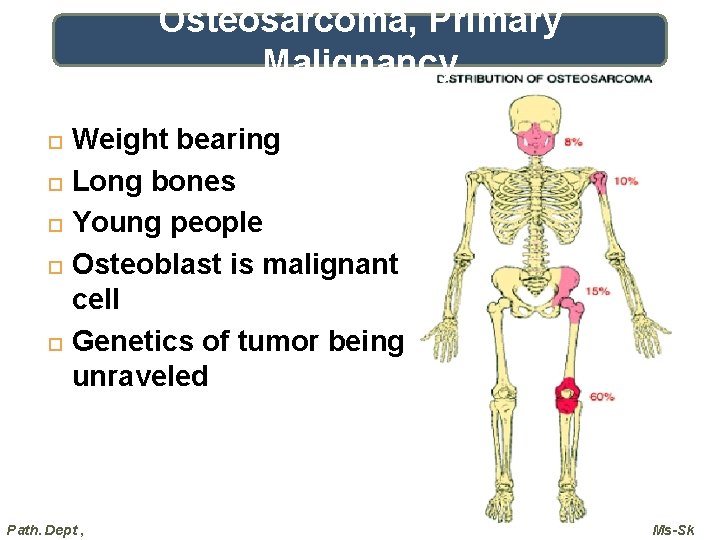 Osteosarcoma, Primary Malignancy Weight bearing Long bones Young people Osteoblast is malignant cell Genetics
