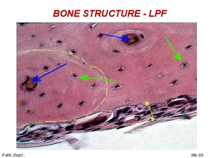 BONE STRUCTURE - LPF Path. Dept , Ms-Sk 