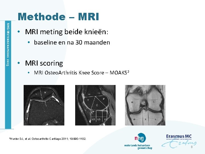Methode – MRI • MRI meting beide knieën: • baseline en na 30 maanden